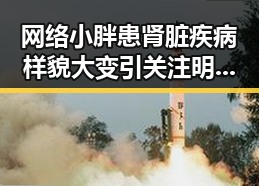 网络小胖患肾脏疾病样貌大变引关注明星演唱会视频揭秘新动态